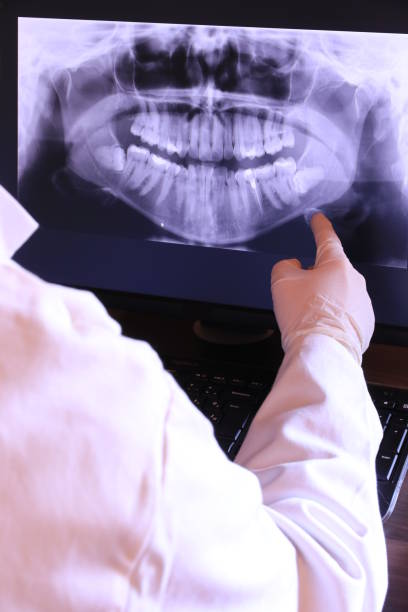 Best Emergency Root Canal Treatment in Rehoboth Beach, DE
